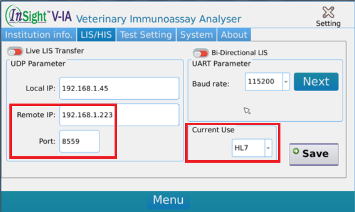 Woodley Insight LIS settings